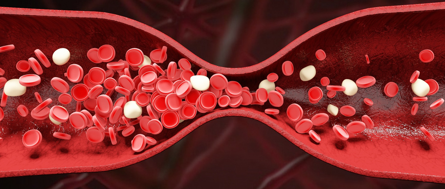 微塑料“入侵”：真相、争议与行动