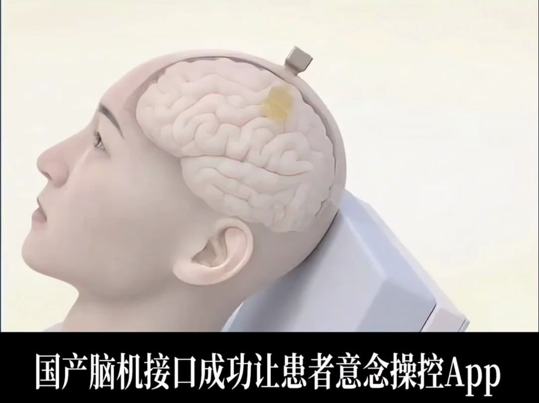 脑机接口，从“解码语言”到更多可能